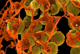 American woman dies of superbug resistant to all antibiotics 
